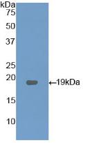 Western blot - Anti-LPCAT3 antibody (AB232958)