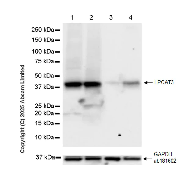 Western blot - Anti-LPCAT3 antibody [EPR28798-172] (AB324941)