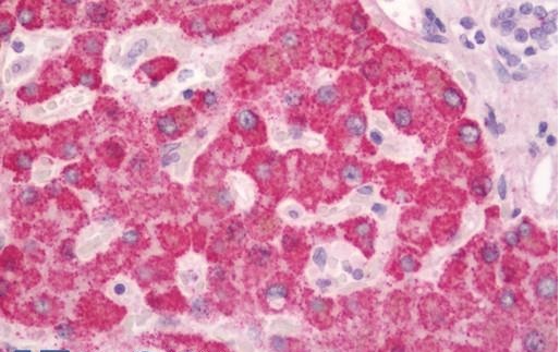 Immunohistochemistry (Formalin/PFA-fixed paraffin-embedded sections) - Anti-LPGAT1 antibody (AB230647)