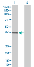 Western blot - Anti-LPGAT1 antibody (AB70076)