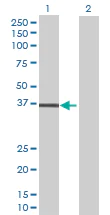 Western blot - Anti-LPGAT1 antibody (AB70076)