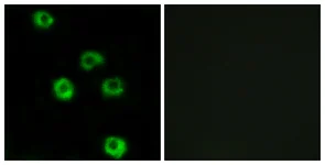 Immunocytochemistry/ Immunofluorescence - Anti-LPHN2 antibody (AB139498)