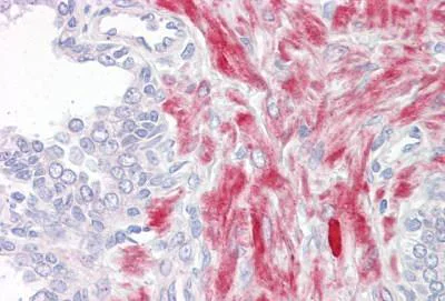 Immunohistochemistry (Formalin/PFA-fixed paraffin-embedded sections) - Anti-LPHN2 antibody (AB139498)