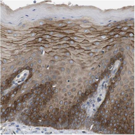 Immunohistochemistry (Formalin/PFA-fixed paraffin-embedded sections) - Anti-LPHN3 antibody (AB150794), expandable thumbnail