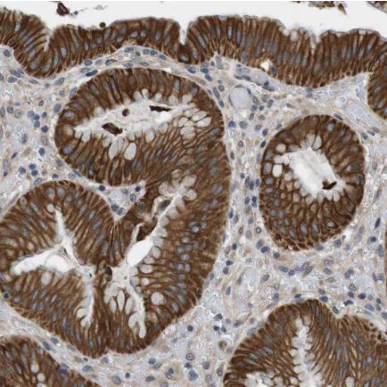 Immunohistochemistry (Formalin/PFA-fixed paraffin-embedded sections) - Anti-LPHN3 antibody (AB150794), expandable thumbnail