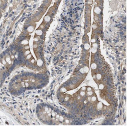 Immunohistochemistry (Formalin/PFA-fixed paraffin-embedded sections) - Anti-LPHN3 antibody (AB150794), expandable thumbnail