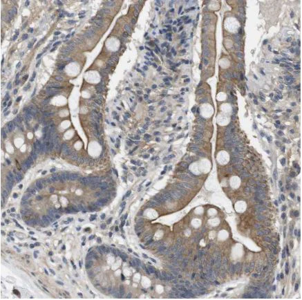 Immunohistochemistry (Formalin/PFA-fixed paraffin-embedded sections) - Anti-LPHN3 antibody (AB150794)