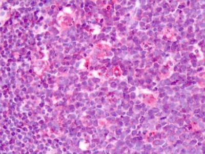 Immunohistochemistry (Formalin/PFA-fixed paraffin-embedded sections) - Anti-LPHN3 antibody - C-terminal (AB140843)
