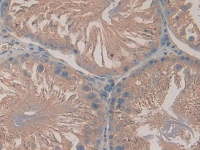 Immunohistochemistry (Formalin/PFA-fixed paraffin-embedded sections) - Anti-LPO antibody (AB231026)