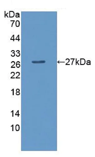 Western blot - Anti-LPO antibody (AB231026)