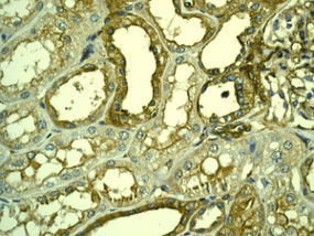 Immunohistochemistry (Formalin/PFA-fixed paraffin-embedded sections) - Anti-LPP antibody [EPR6478] - BSA and Azide free (AB248124), expandable thumbnail