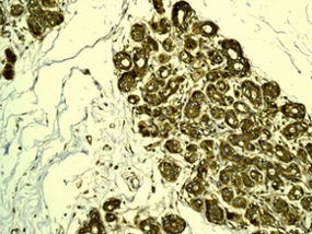 Immunohistochemistry (Formalin/PFA-fixed paraffin-embedded sections) - Anti-LPP antibody [EPR6478] - BSA and Azide free (AB248124), expandable thumbnail
