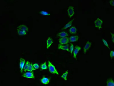 Immunocytochemistry/ Immunofluorescence - Anti-LR8 antibody (AB236860)