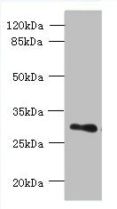 Western blot - Anti-LR8 antibody (AB236860)