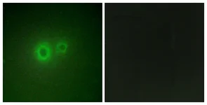 Immunocytochemistry/ Immunofluorescence - Anti-LRAT antibody (AB166784)