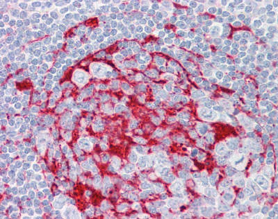 Immunohistochemistry (Formalin/PFA-fixed paraffin-embedded sections) - Anti-LRAT antibody (AB166784)