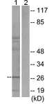 Western blot - Anti-LRAT antibody (AB166784)