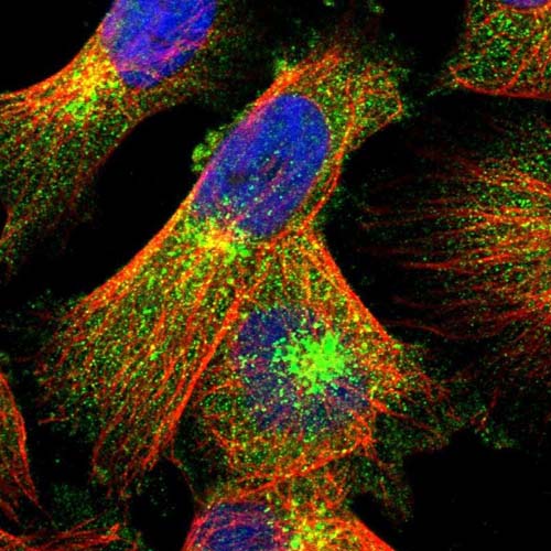 Immunocytochemistry/ Immunofluorescence - Anti-LRBA/BGL antibody (AB121601), expandable thumbnail