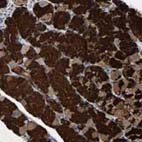 Immunohistochemistry (Formalin/PFA-fixed paraffin-embedded sections) - Anti-LRBA/BGL antibody (AB121601), expandable thumbnail