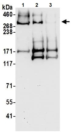 Western blot - Anti-LRBA/BGL antibody (AB191174)