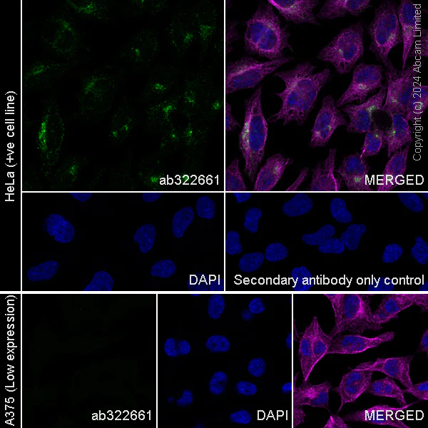 Immunocytochemistry/ Immunofluorescence - Anti-LRBA/BGL antibody [EPR29133-75] (AB322661)