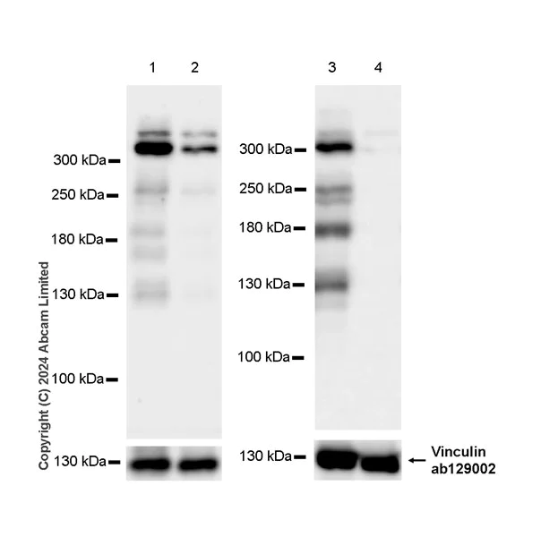Western blot - Anti-LRBA/BGL antibody [EPR29133-75] (AB322661)