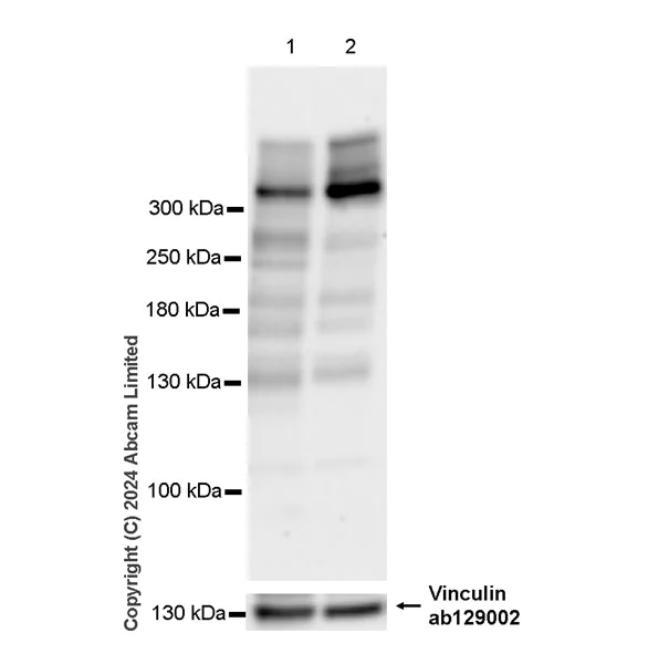 Western blot - Anti-LRBA/BGL antibody [EPR29133-75] (AB322661)