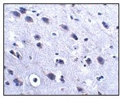 Immunohistochemistry (Formalin/PFA-fixed paraffin-embedded sections) - Anti-LRFN2 antibody (AB106366)