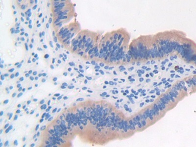 Immunohistochemistry (Formalin/PFA-fixed paraffin-embedded sections) - Anti-LRG1/LRG antibody (AB231188), expandable thumbnail