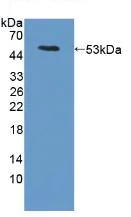 Western blot - Anti-LRG1/LRG antibody (AB231188)