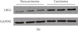 Western blot - Anti-LRG1/LRG antibody [EPR12362] (AB178698), expandable thumbnail