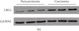 Western blot - Anti-LRG1/LRG antibody [EPR12362] (AB178698)
