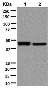 Western blot - Anti-LRG1/LRG antibody [EPR12362] (AB178698)