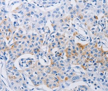 Immunohistochemistry (Formalin/PFA-fixed paraffin-embedded sections) - Anti-LRIG1 antibody (AB197985)