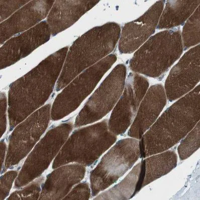 Immunohistochemistry (Formalin/PFA-fixed paraffin-embedded sections) - Anti-LRIG2 antibody (AB121472)
