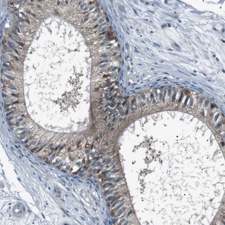 Immunohistochemistry (Formalin/PFA-fixed paraffin-embedded sections) - Anti-LRIG2 antibody (AB121472)