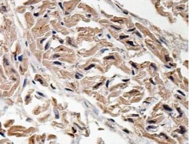 Immunohistochemistry (Formalin/PFA-fixed paraffin-embedded sections) - Anti-LRIG2 antibody (AB157492)