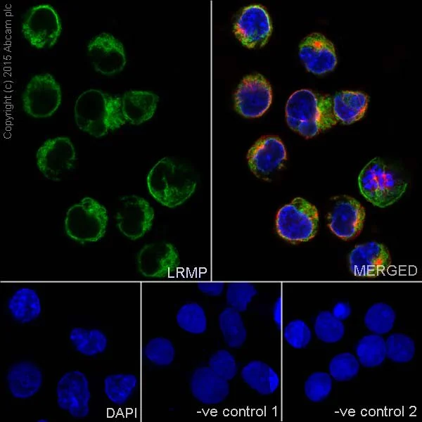 Immunocytochemistry/ Immunofluorescence - Anti-LRMP antibody [EPR17852] - BSA and Azide free (AB251368)