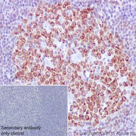 Immunohistochemistry (Formalin/PFA-fixed paraffin-embedded sections) - Anti-LRMP antibody [EPR17852] - BSA and Azide free (AB251368)