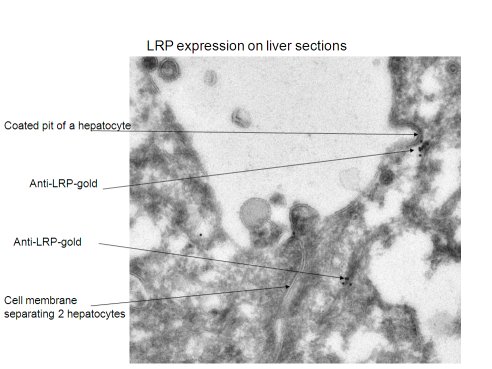 Electron Microscopy - Anti-LRP1 antibody [8G1] (AB20384), expandable thumbnail