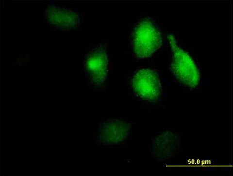 Immunocytochemistry/ Immunofluorescence - Anti-LRP1 antibody (AB168454)