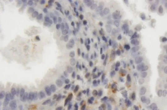 Immunohistochemistry (Formalin/PFA-fixed paraffin-embedded sections) - Anti-LRP1 antibody (AB168454)