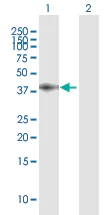 Western blot - Anti-LRP1 antibody (AB168454)