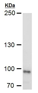 Western blot - Anti-LRP1 antibody - C-terminal (AB227734)
