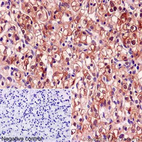 Immunohistochemistry (Formalin/PFA-fixed paraffin-embedded sections) - Anti-LRP1 antibody [EPR3724] (AB92544)