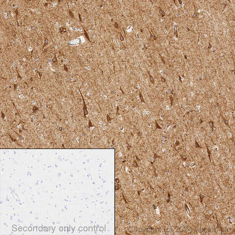 Immunohistochemistry (Formalin/PFA-fixed paraffin-embedded sections) - Anti-LRP1 antibody [EPR3724] (AB92544)