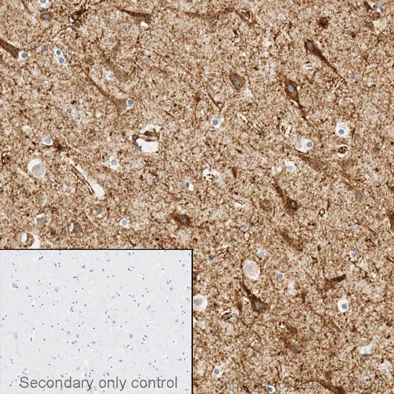 Immunohistochemistry (Formalin/PFA-fixed paraffin-embedded sections) - Anti-LRP1 antibody [EPR3724] (AB92544)