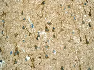 Immunohistochemistry (Formalin/PFA-fixed paraffin-embedded sections) - Anti-LRP1 antibody [EPR3724] - BSA and Azide free (AB215997)