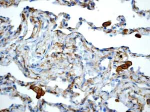 Immunohistochemistry (Formalin/PFA-fixed paraffin-embedded sections) - Anti-LRP1 antibody [EPR3724] - BSA and Azide free (AB215997)