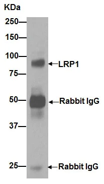 Immunoprecipitation - Anti-LRP1 antibody [EPR3724] - BSA and Azide free (AB215997)